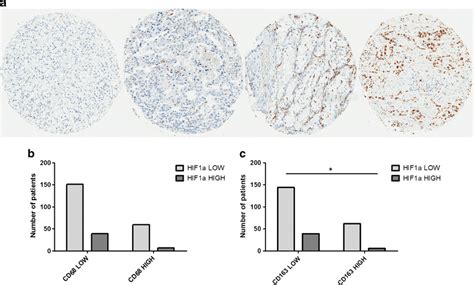 Tumour Infiltration By Cd163 Macrophages Assessed By Immunochemistry Download Scientific