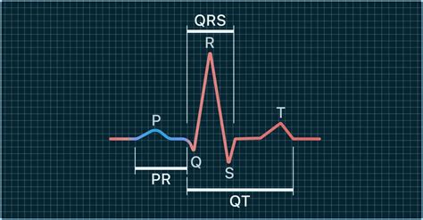 What PR QRS And QTc Intervals Mean On Your Watch ECG Qaly