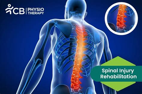 What is Spinal Injury Rehabilitation? What does Spinal Injury ...