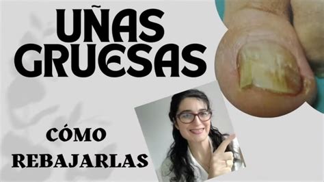 Descubre cómo ablandar las uñas de los pies de forma sencilla y