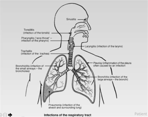 Airways Airways Disease Flashcards Quizlet