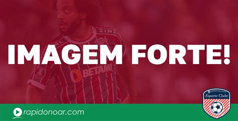 Imagem Forte Marcelo Do Fluminense Expulso Ap S Quebrar Perna De