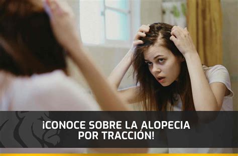 Conoce Sobre La Alopecia Por Tracci N Capilar Center