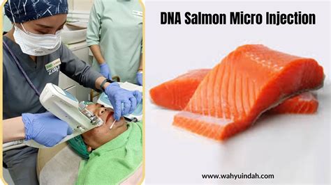 Dna Salmon Di Zap Clinic Malang