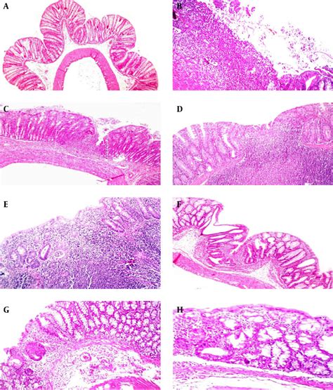 Histopathological Evaluations Of The Colon Tissues Download Scientific Diagram