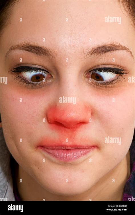 Young Woman With A Cold And Red Nose Stock Photo Royalty Free Image