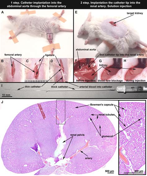 Main Stages Of The Minimally Invasive Mouse Renal Artery Download