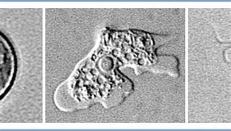 Naegleria Fowleri Cyst