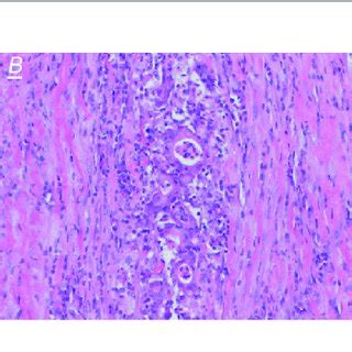 Representative Images Of Hematoxylin Eosin Staining Of Ntrk