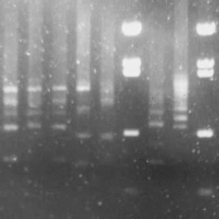 Taq I RFLP Profiles Of 16S RDNA Amplified In PCR Primed By