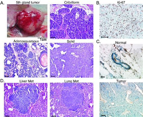 Expression Of C Myc T A Induces Mammary Adenocarcinoma With An Average