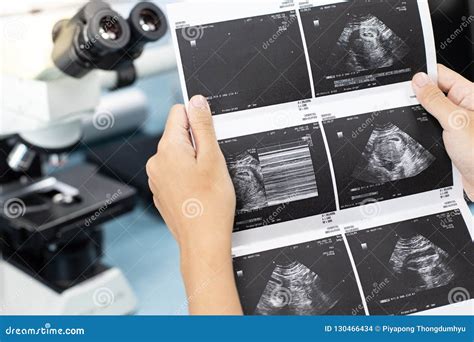 Ultrasound of Baby in Pregnant Woman, Doctor Reading Test Results of ...