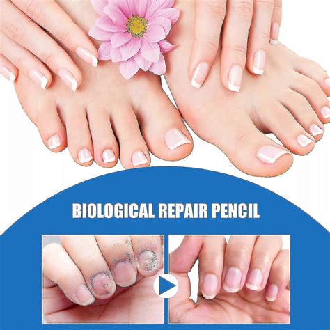 South Moon Onychomycosis Repair Solution Hands and Feet Thickens Bright