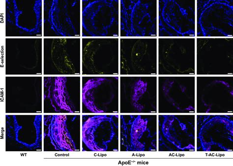 Expression Of E Selectin And Icam Proteins In Aortic Root Lesions