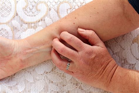 Understanding And Managing Itchy Skin In Older Adults Causes And