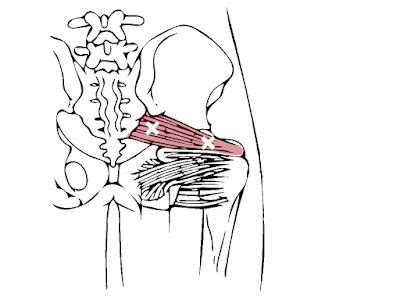 Trigger Points: Piriformis Trigger Points and Referral Patterns