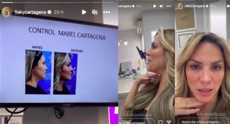 Mabel Cartagena Compartió El Antes Y El Después De Su Cambio Gracias A