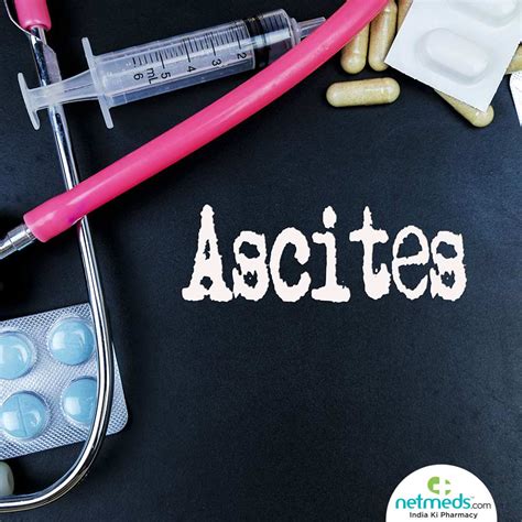 Ascites: Causes, Symptoms And Treatment | Netmeds