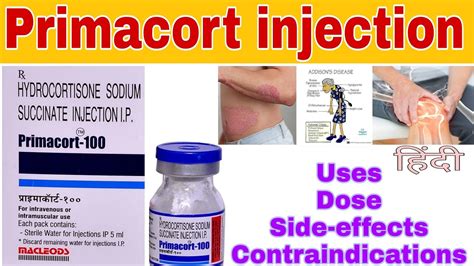 Hydrocortisone Injection Primacort Injection Uses Dose Side Effects