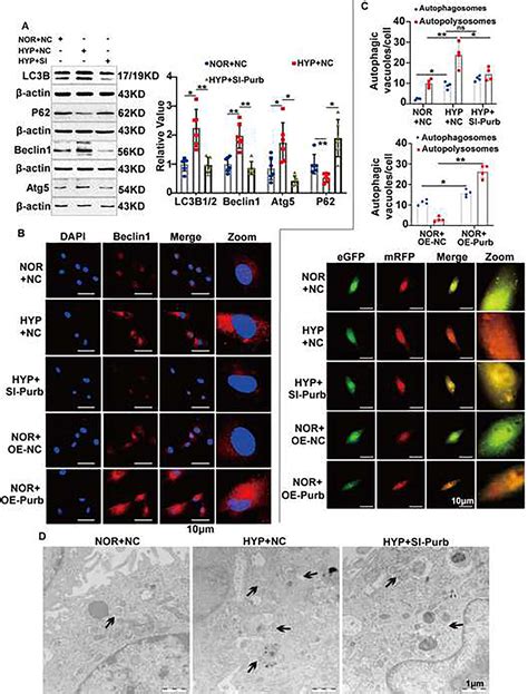 Circ Calm Regulates Hypoxia Induced Pulmonary Artery Smooth Muscle