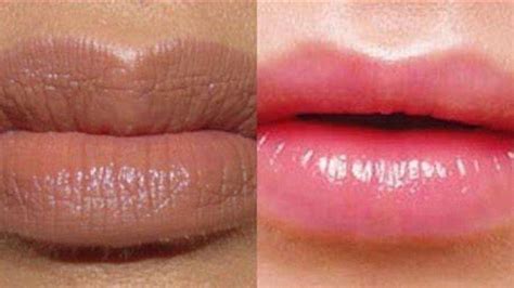 Mudah Begini Tips Bagi Wanita Untuk Mencerahkan Bibir Serambinews