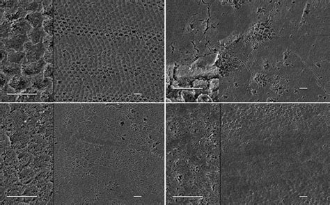 Scanning Electron Micrographs (each a composition of 2 magnification ...