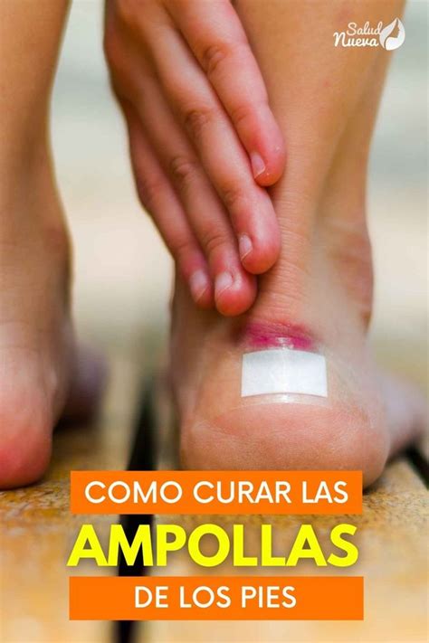 3 Remedios Naturales Para Curar Las Ampollas De Los Pies Salud Nueva