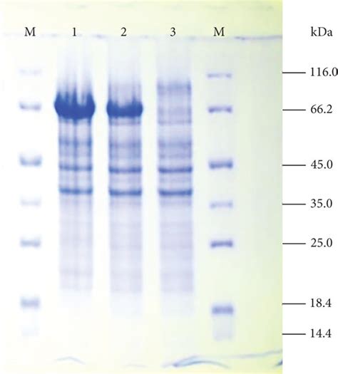 SDS PAGE Analysis For Partial Purification Of Chitinase From Bacillus