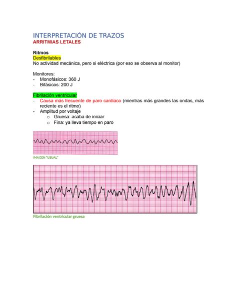 Bradis Taquis Interpretaci N De Trazos Arritmias Letales Ritmos