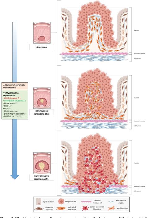 Figure 1 From Fibroblast Subsets In Intestinal Homeostasis Carcinogenesis Tumor Progression