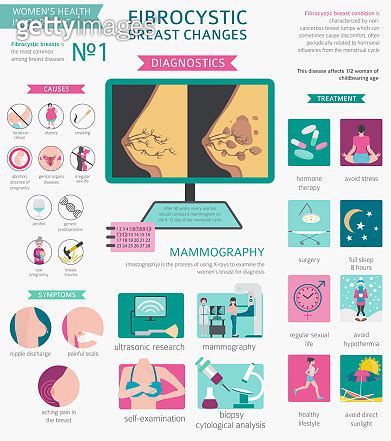 Fibrocystic Breast Changes Disease Medical Infographic Diagnostics