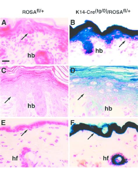 Characterisation Of Cre Recombinase Activity In Skin Of The K Cre