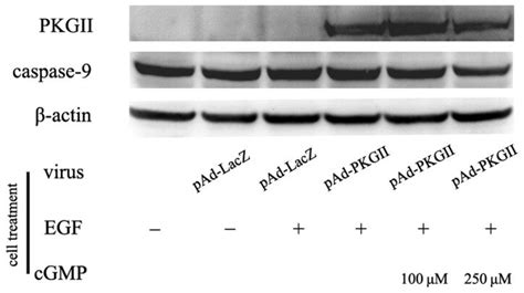 Pkg Ii Inhibits The Activation Of Caspase The Ags Cells Were Treated