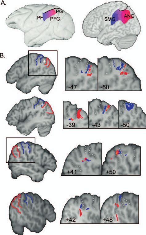 Local Connectivity Of The Human Posterior Supramarginal Gyrus A The Download Scientific