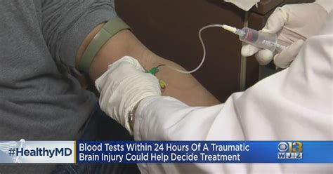 Healthwatch Blood Tests Within 24 Hours Of Traumatic Brain Injuries