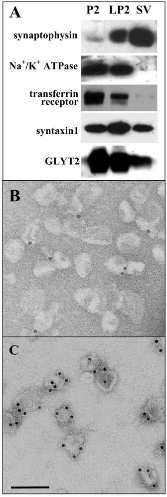 Immunogold Labeling On A Synaptic Vesicle Preparation Demonstrates The