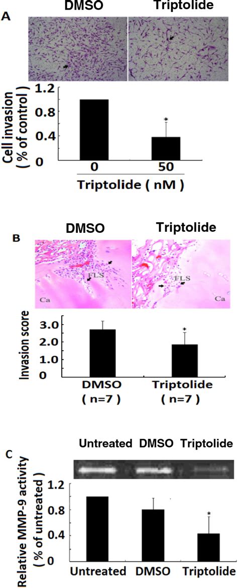 Figure 1 From Triptolide Inhibits The Migration And Invasion Of