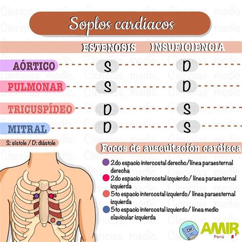 Soplos cardiacos Cosas de enfermeria Anatomía médica Fundamentos de