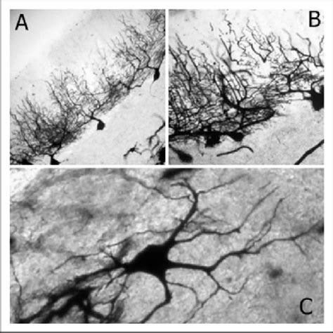 A Purkinje Cells From The Posterior Lobe Of The Cerebellar