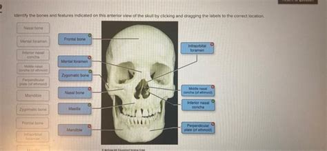 Solved Identify The Bones And Features Indicated On This Chegg