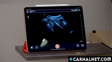 Ultrasound Videos XVIDEOS