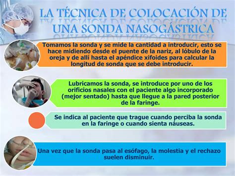 Colocación de sonda nasogástrica PPT