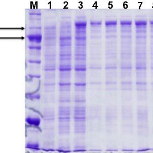 SDS PAGE Analysis Of The Expression Of The Metagenome Galactosidase