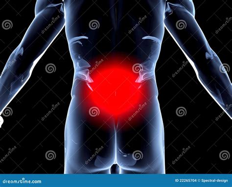 Back Ache - Anatomy stock illustration. Illustration of chirurgic ...