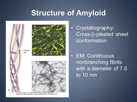 Beta Pleated Sheet Amyloid