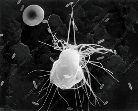 Alveolar Macrophage Phagocytosis Of E Coli SEM Stock Image C037