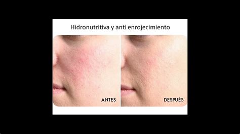 Gel descongestivo Dr Fontboté rosácea antienrojecimiento rostro y