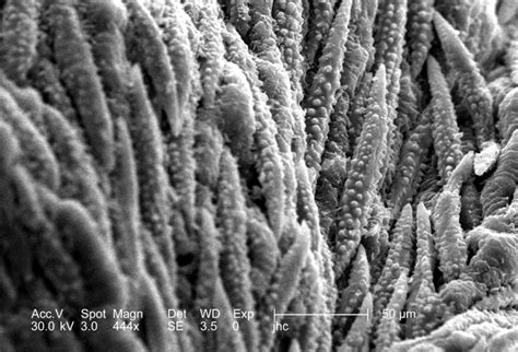 Free picture: electron micrograph, morphologic, ultrastructural, surface 