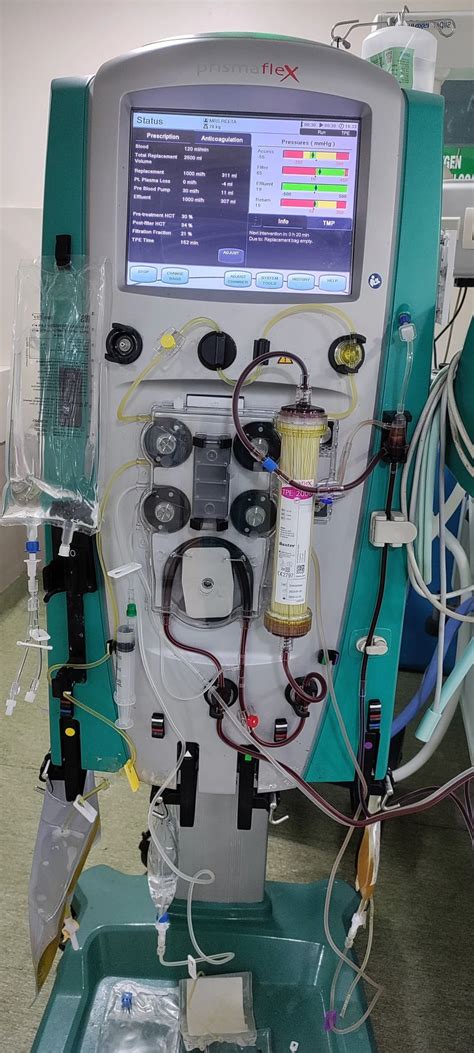 dinesh suresh  linkedin baxter crrt renal