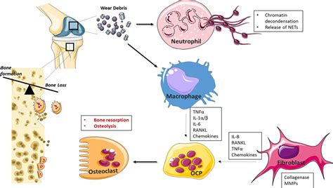 Frontiers Disease Associated Particulates And Joint Inflammation